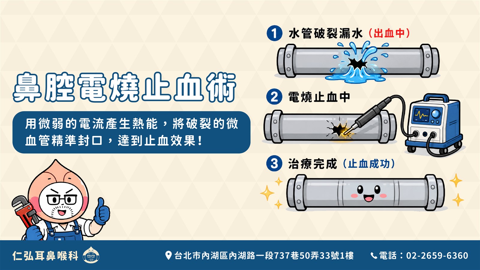 鼻腔電燒止血術原理