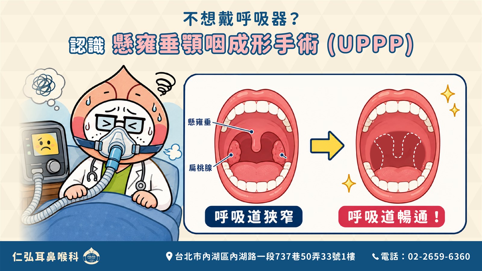 不想戴呼吸器 認識懸雍垂顎咽成形手術 UPPP